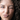 Why the Skin Around Your Eyes Ages Faster