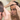 Why Men's Hair Thins Earlier Than Women's