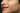 What Causes Dark Spots on Skin?