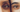 Why Your Under-Eye Area Shows Signs of Fatigue First
