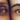 Why Your Under-Eye Area Shows Signs of Fatigue First